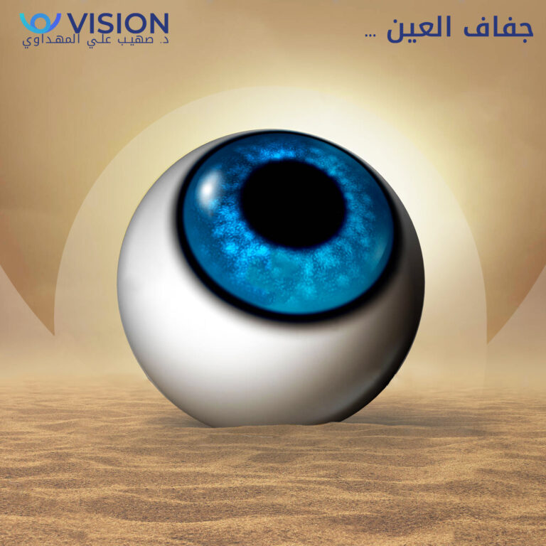 جفاف العين 1 768x768
