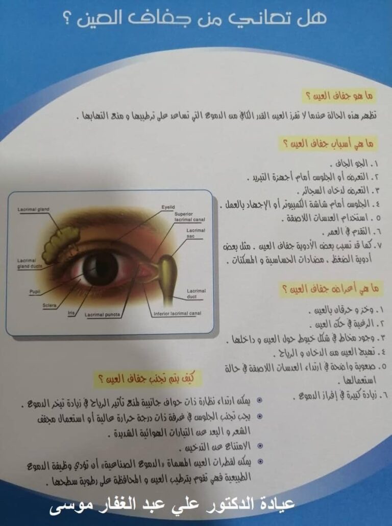 جفاف العين 2 768x1029