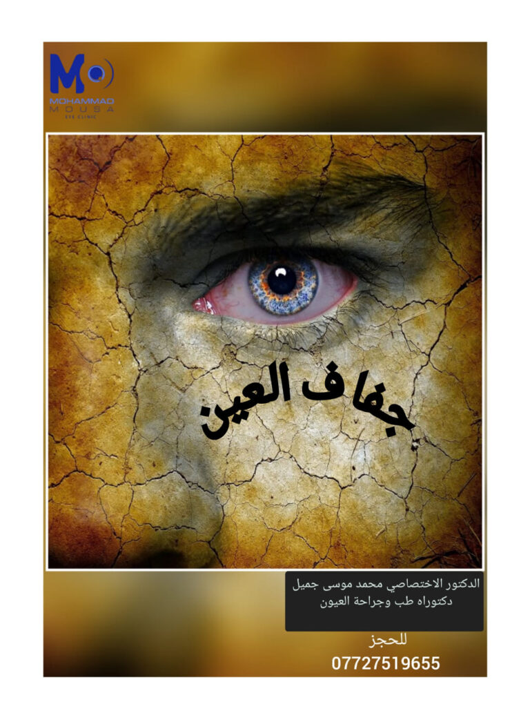 جفاف العين 3 768x1046