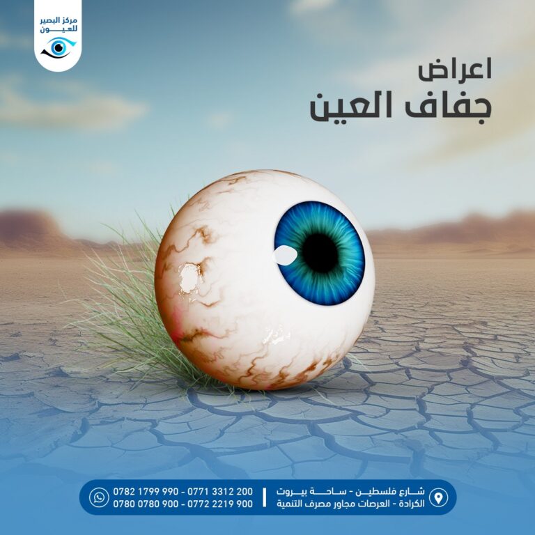 جفاف العين 4 768x768