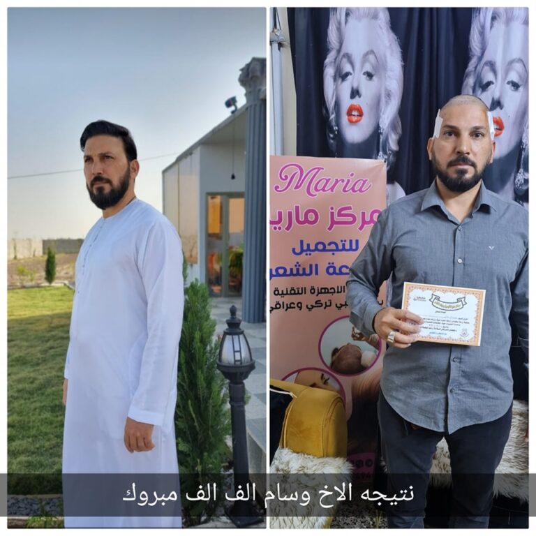 جمال الزراعه 768x768