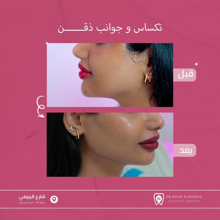 جوانب ذقن 768x768