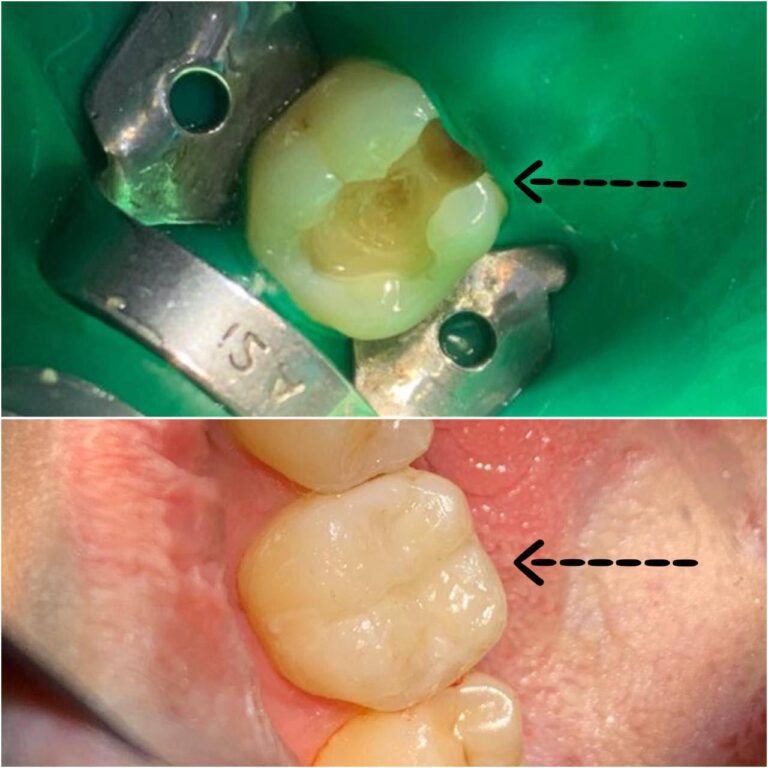 حشوات تجميل 768x768