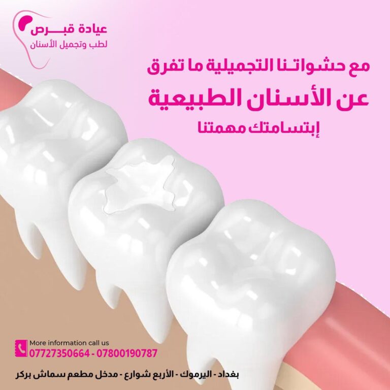 حشوه تجميل 1 768x768