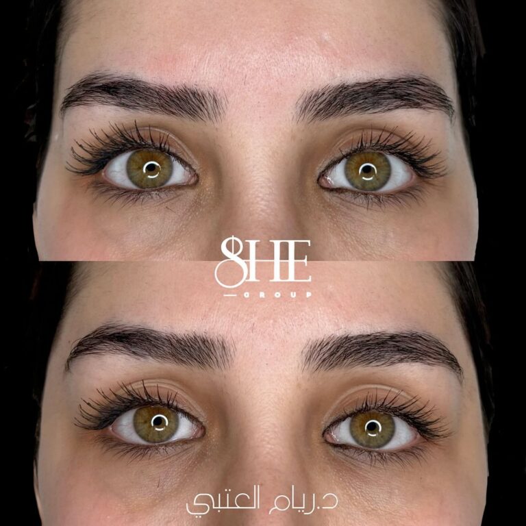 حق الاصداغ 768x768