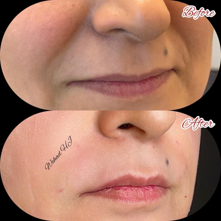 حق الوجه 1 768x768