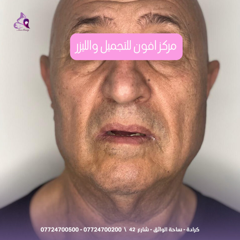 حق الوجه 2 768x768