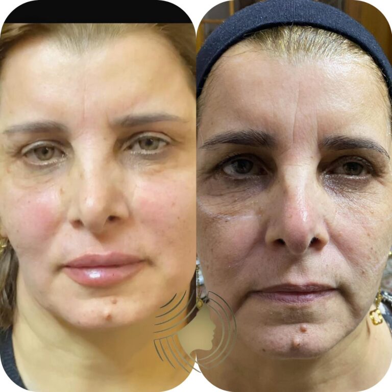 حق الوجه 768x768