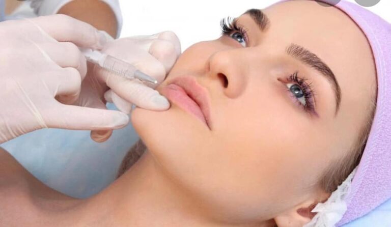حقن شفاه 768x446