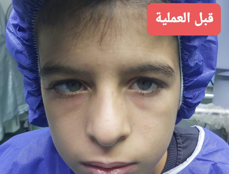 حول العين 2 768x585