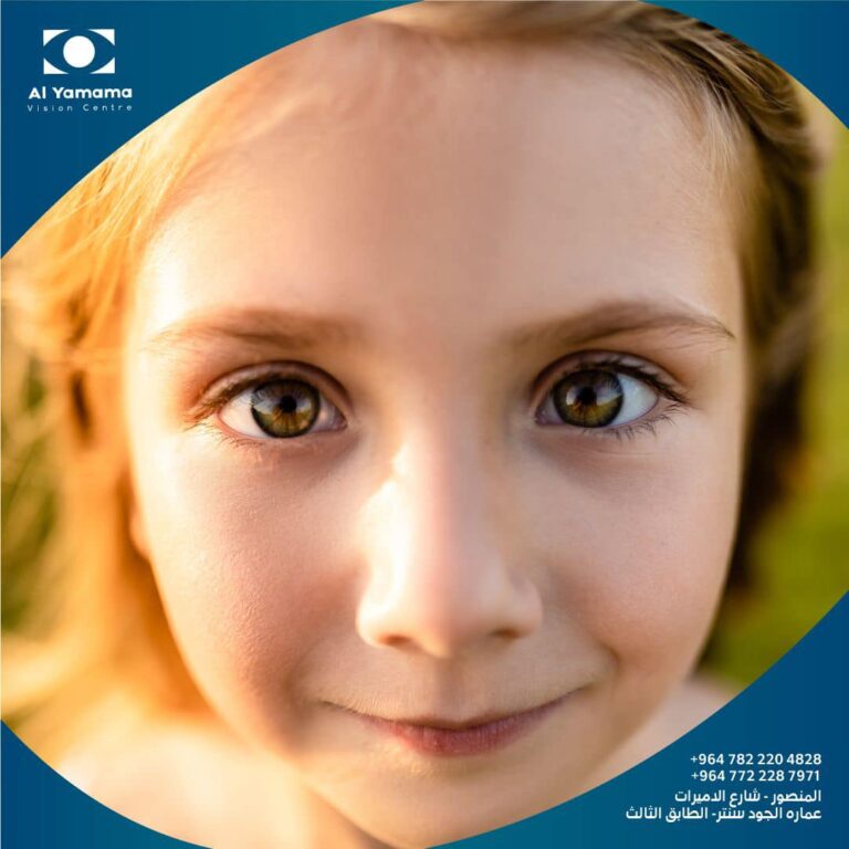 حول العين 768x768