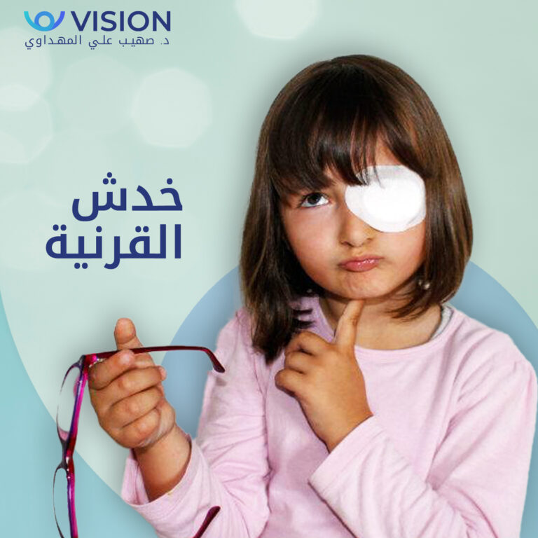 خدش القرنيه 768x768