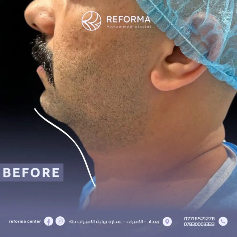 ذقن للراجل 768x768