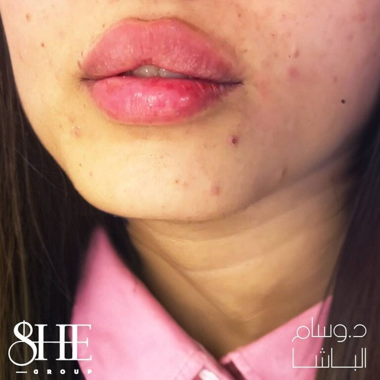 رسم شفاه 1 768x768