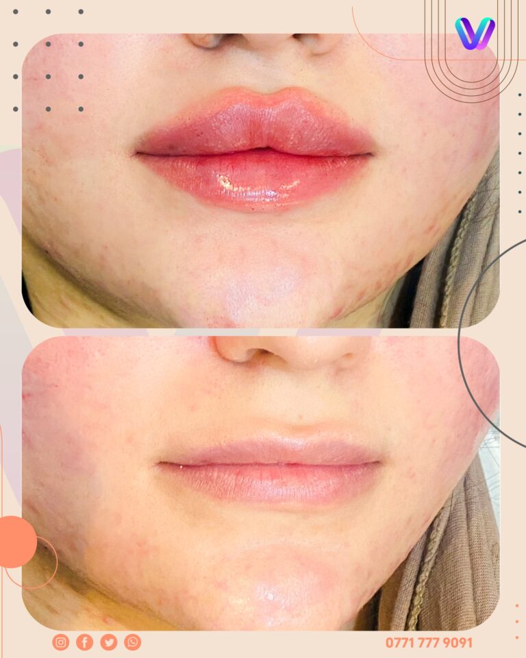 رسم شفاه 768x960