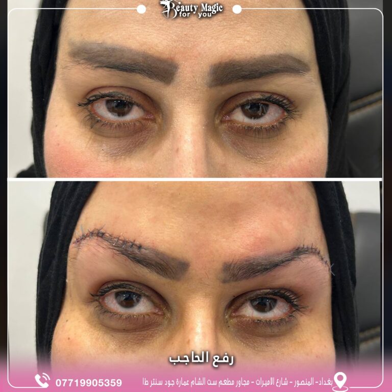 رفع حاجب 768x768