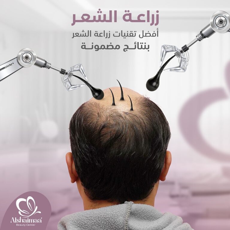 زراعة الشعر 1 768x768