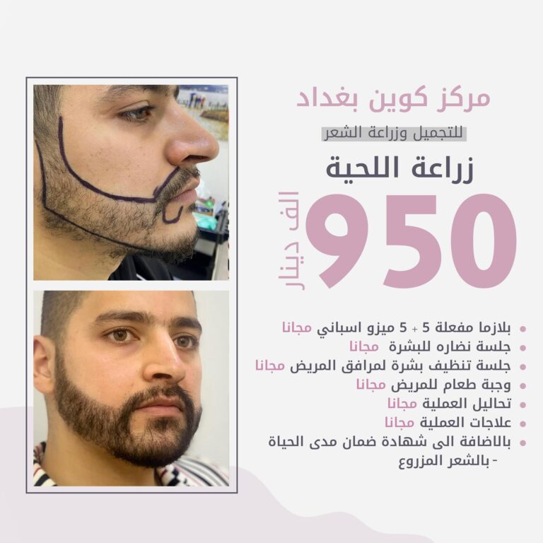 زراعة لحيه 768x768