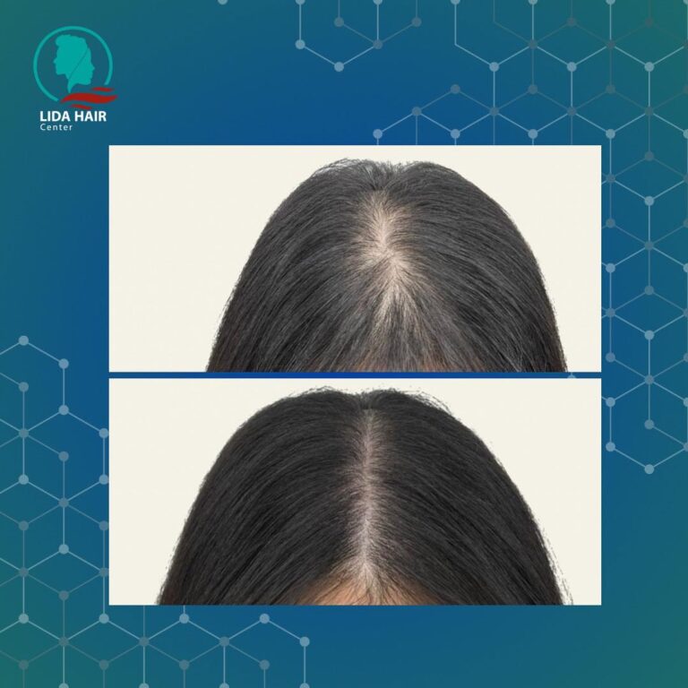 زراعه 1 768x768