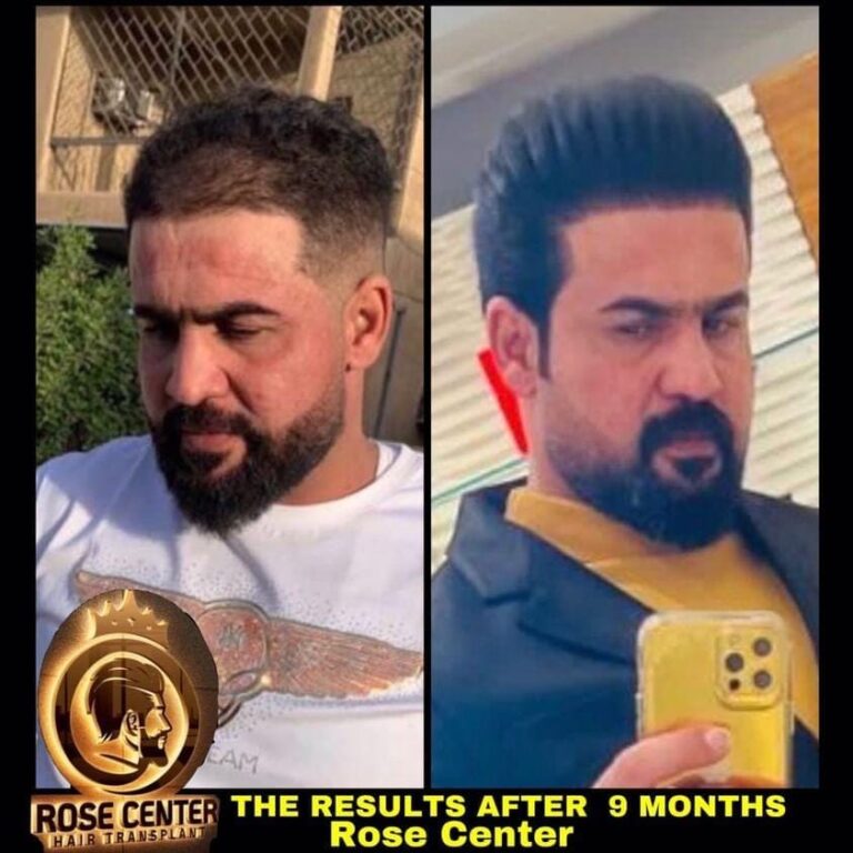 زراعه 2 768x768