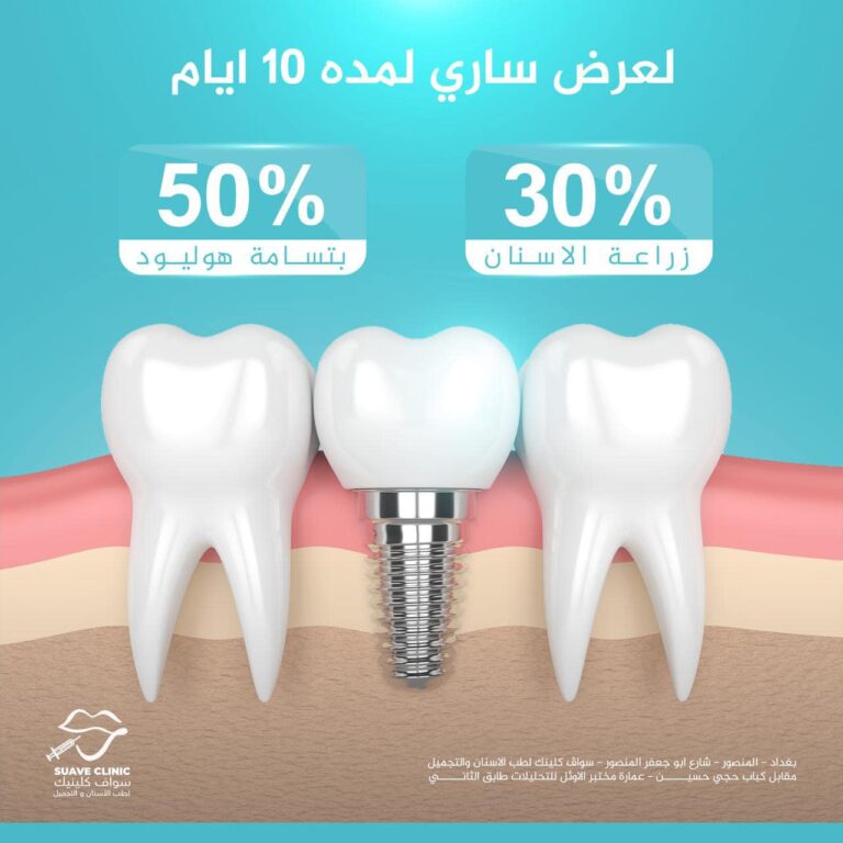 زراعه اسنان 2 768x768