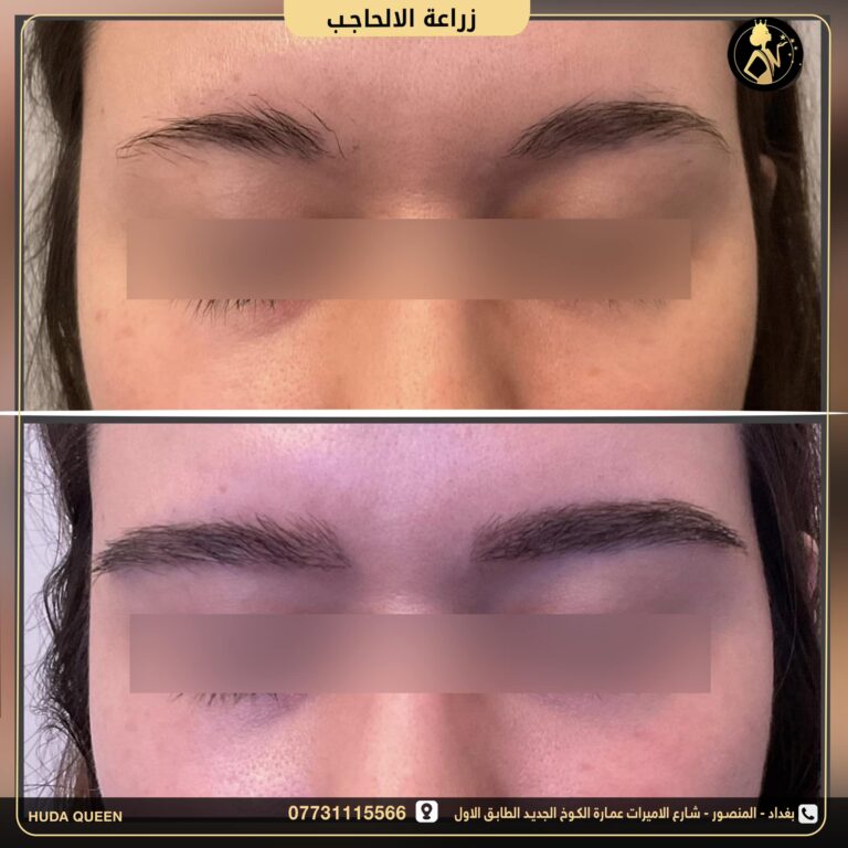 زراعه الحاجب 768x768