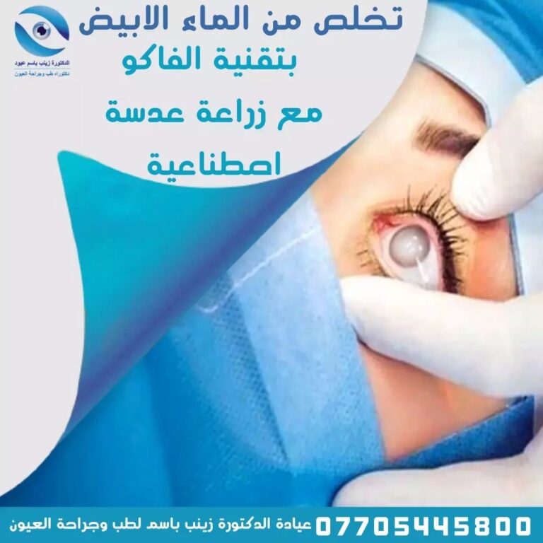 زرع عدسة 768x768