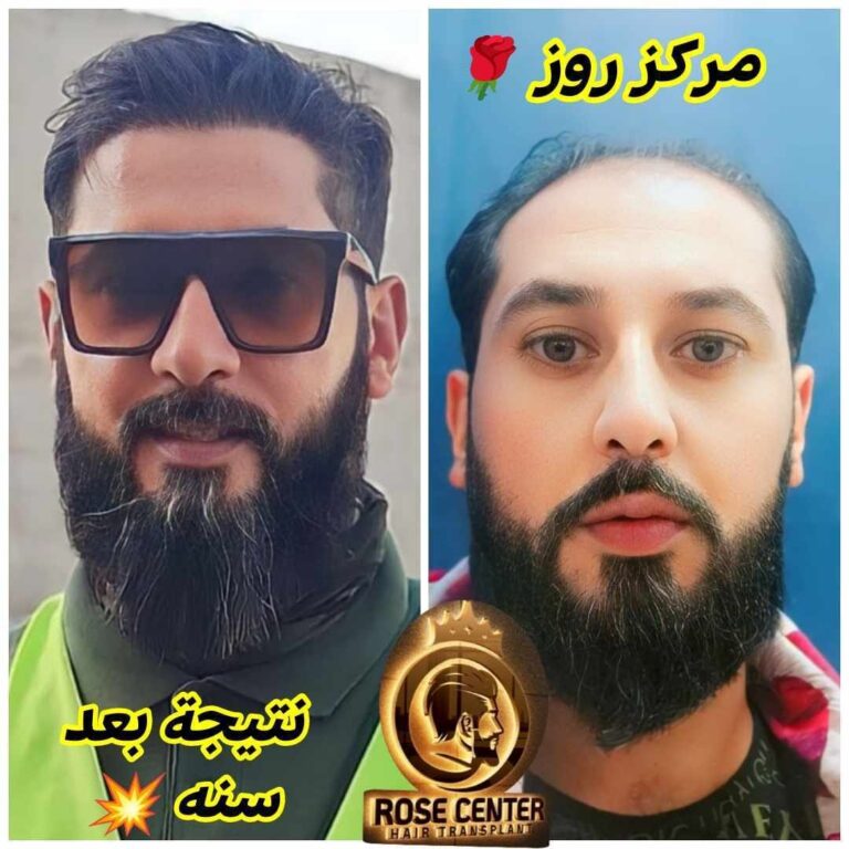 زورونا 768x768