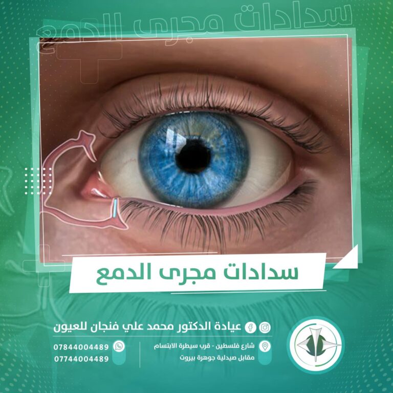 سداد مجرى الدمع 768x768