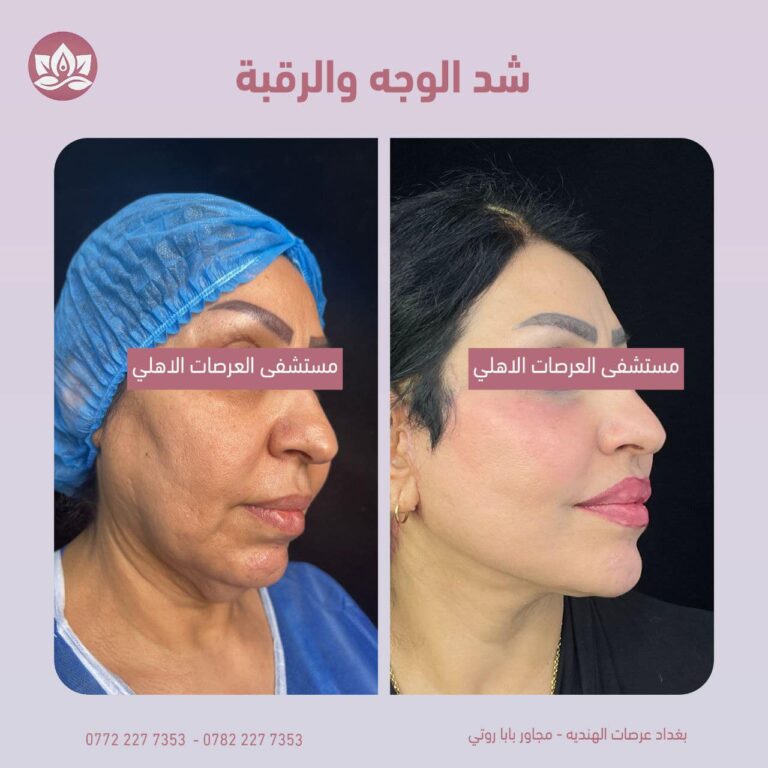 شد الوجه والرقبه 768x768