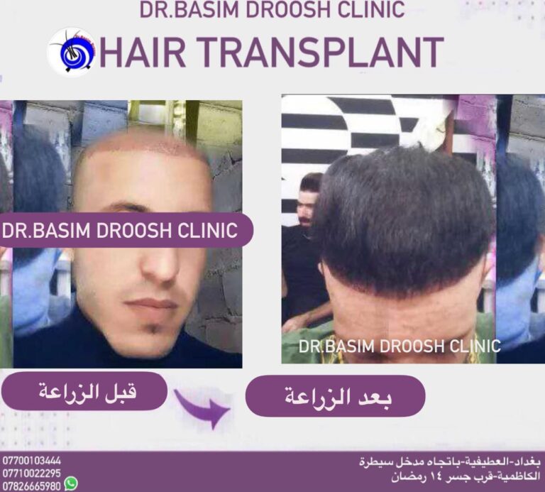 شعر زراعه 5 768x693