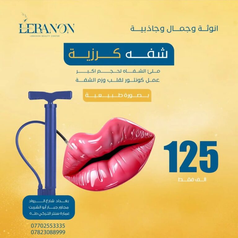 شفاه كرزيه 768x768