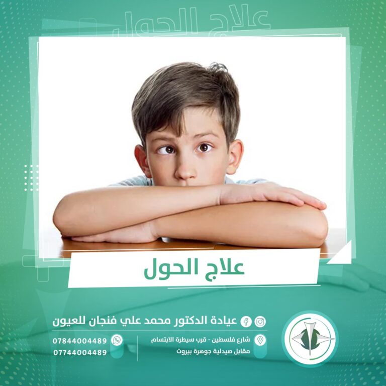 علاج الحول 1 768x768