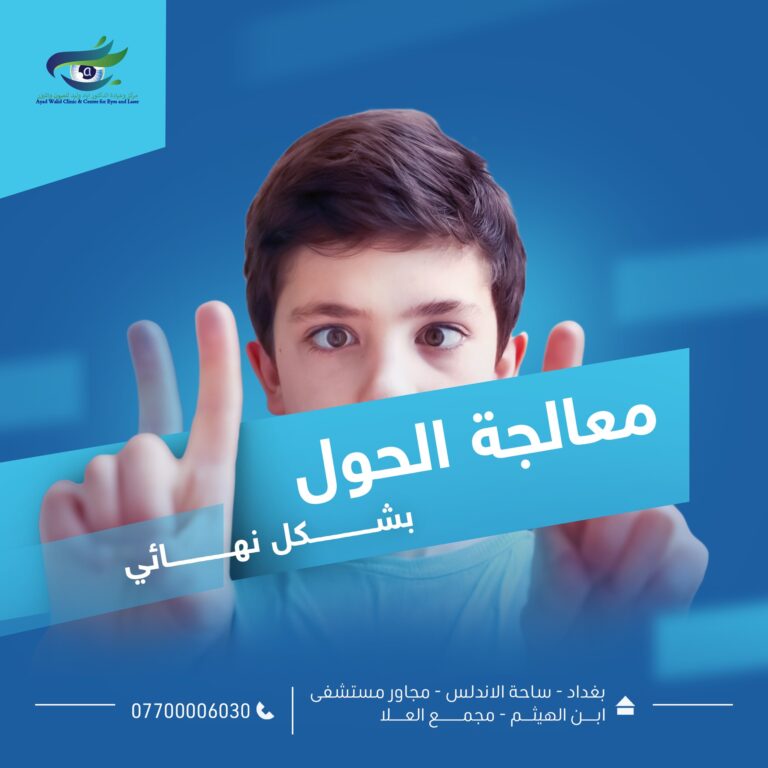 علاج الحول 768x768