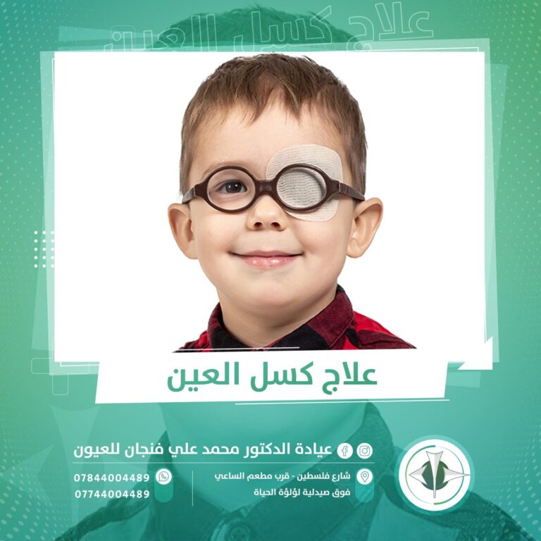 علاج العين الكسوله 768x768