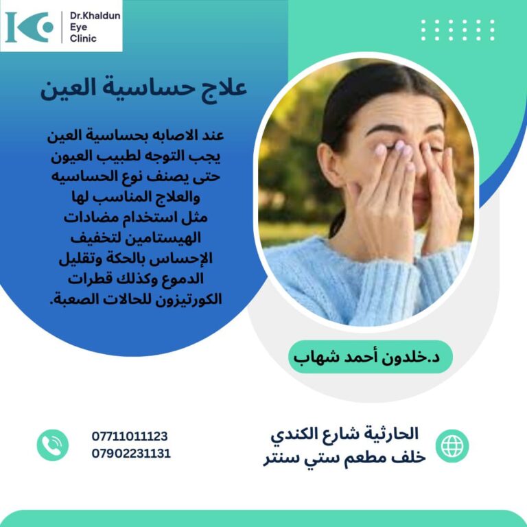 علاج حساسيه العين 768x768