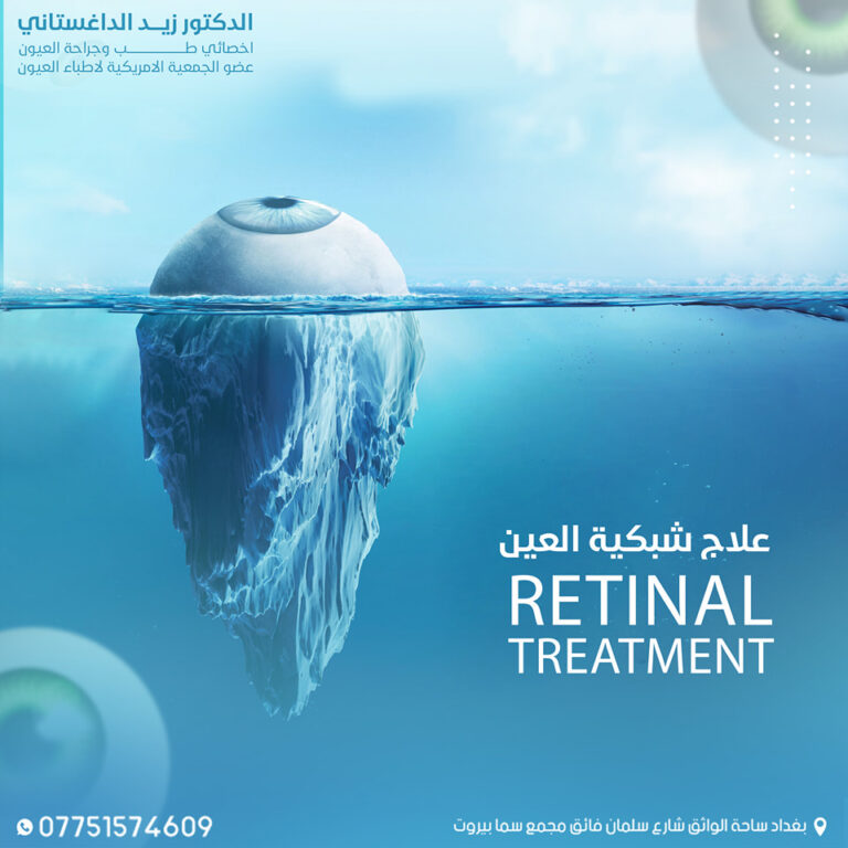 علاج شبكة العين 768x768