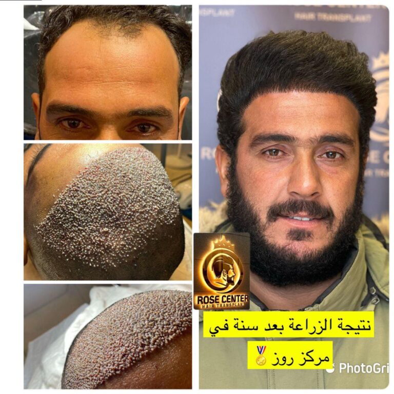 عمل ممتاز زراعه 768x768