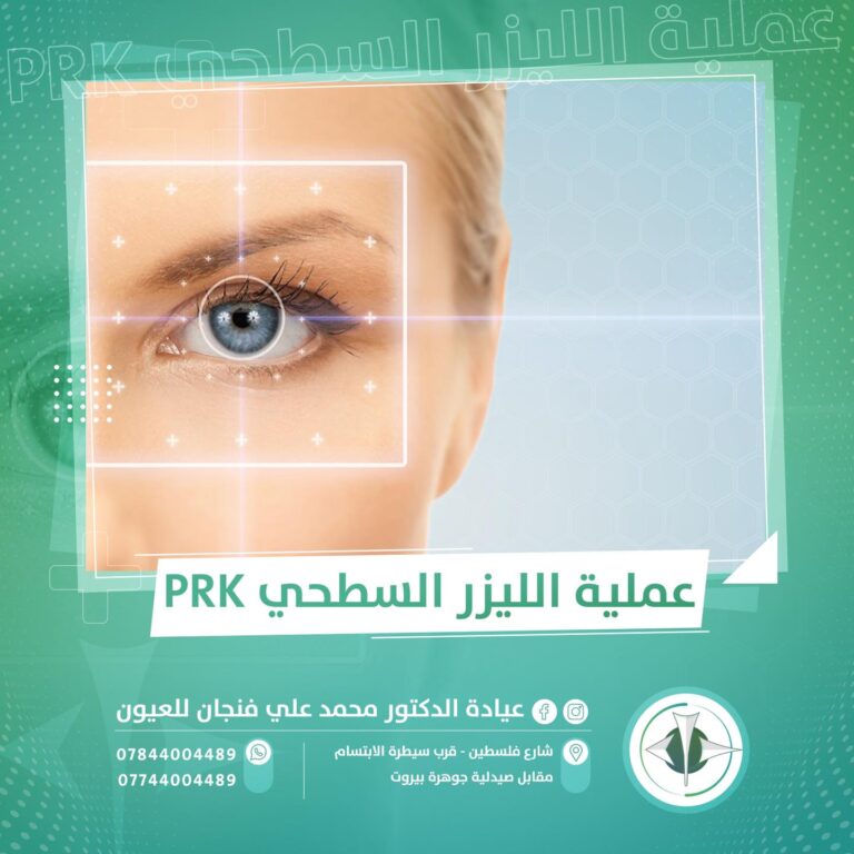 عمليه الليزر السطحي 768x768