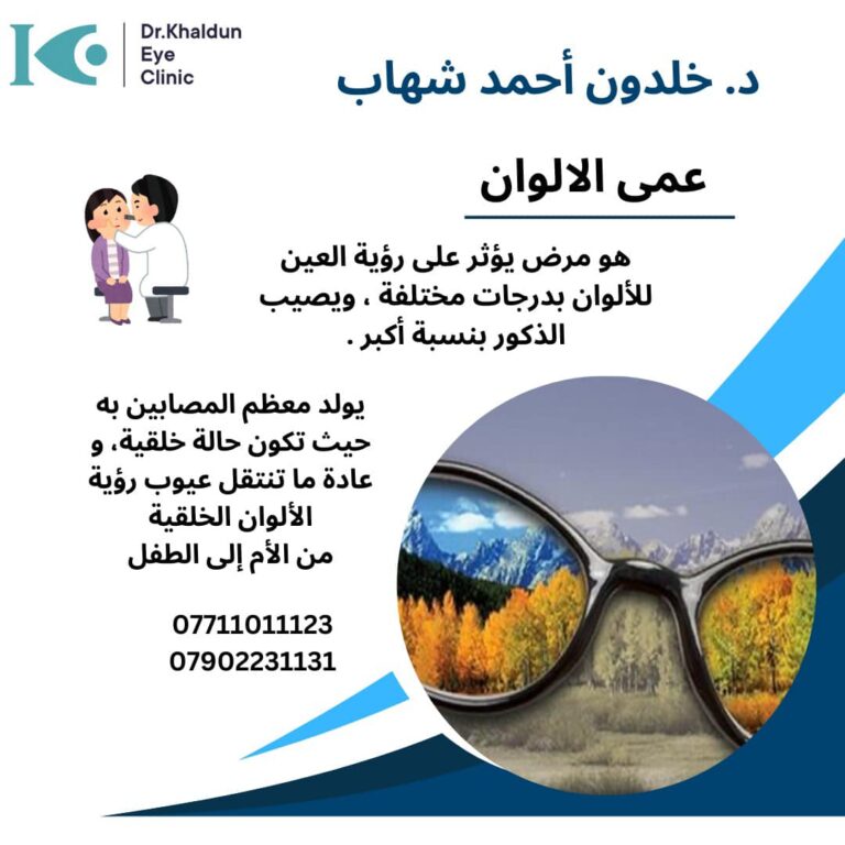 عمى اللوان 768x768