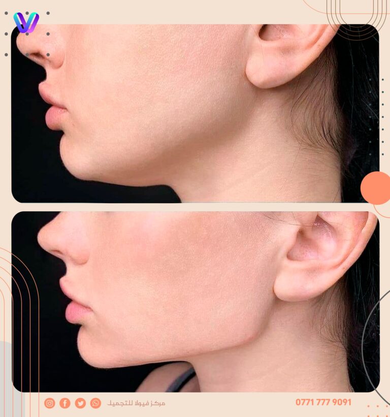 فك تكساس 768x821