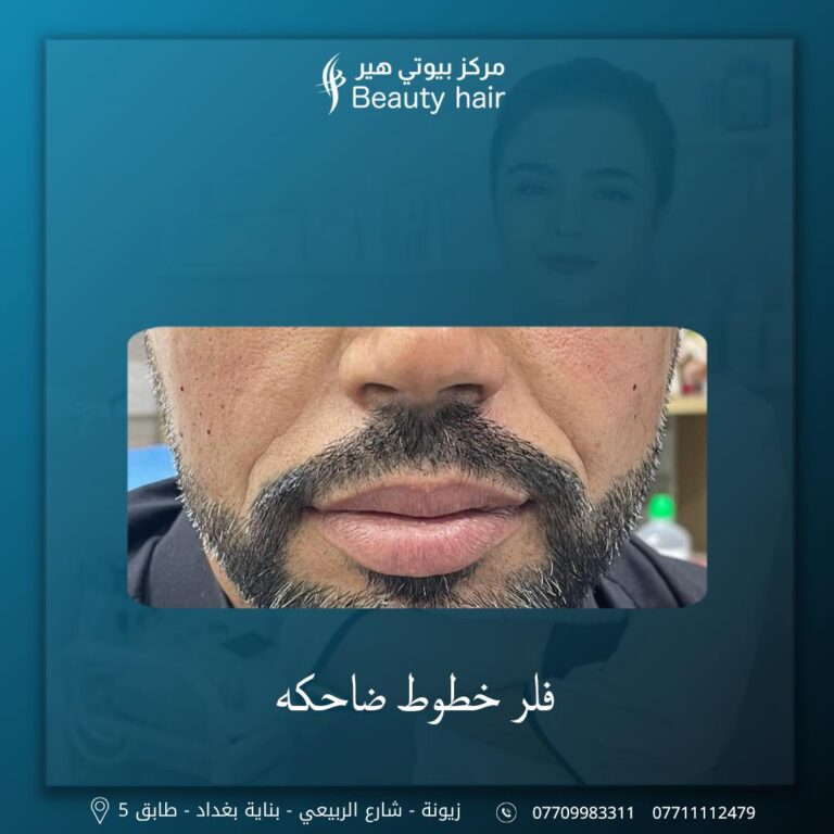 فلر خطوط ضاحكه 768x768