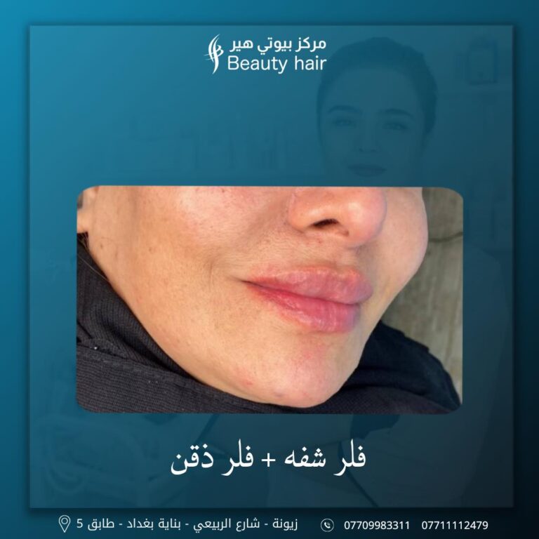 فلر ذقن 768x768