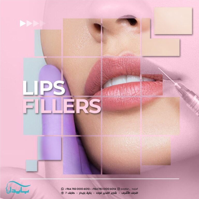 فلر شفاه 19 768x768