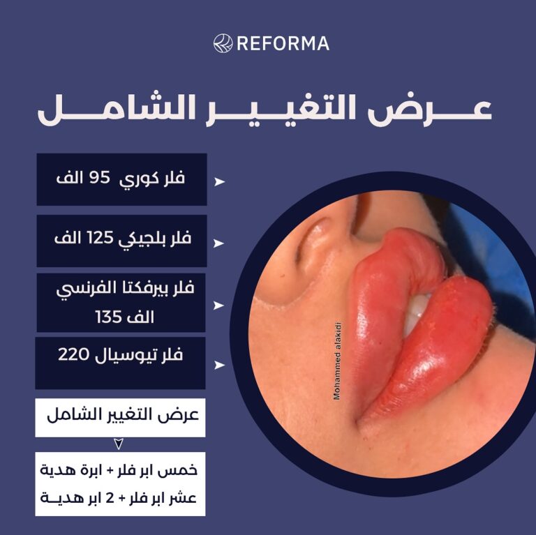 قسم الفلر 1 768x767