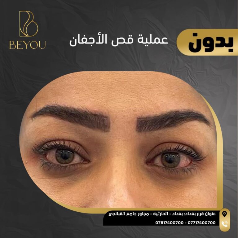 قص اجفان 768x768