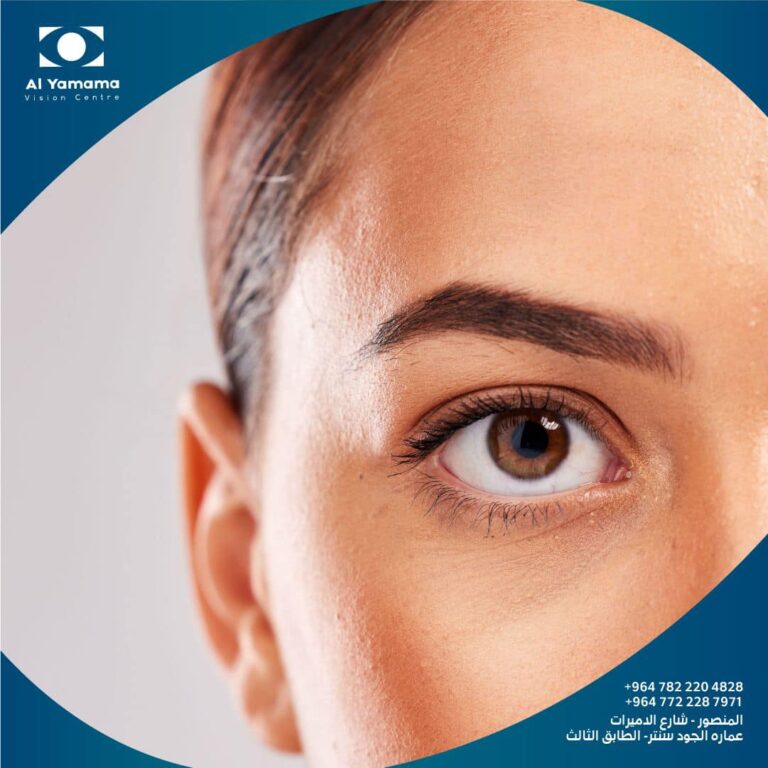 قصر النظر 1 768x768