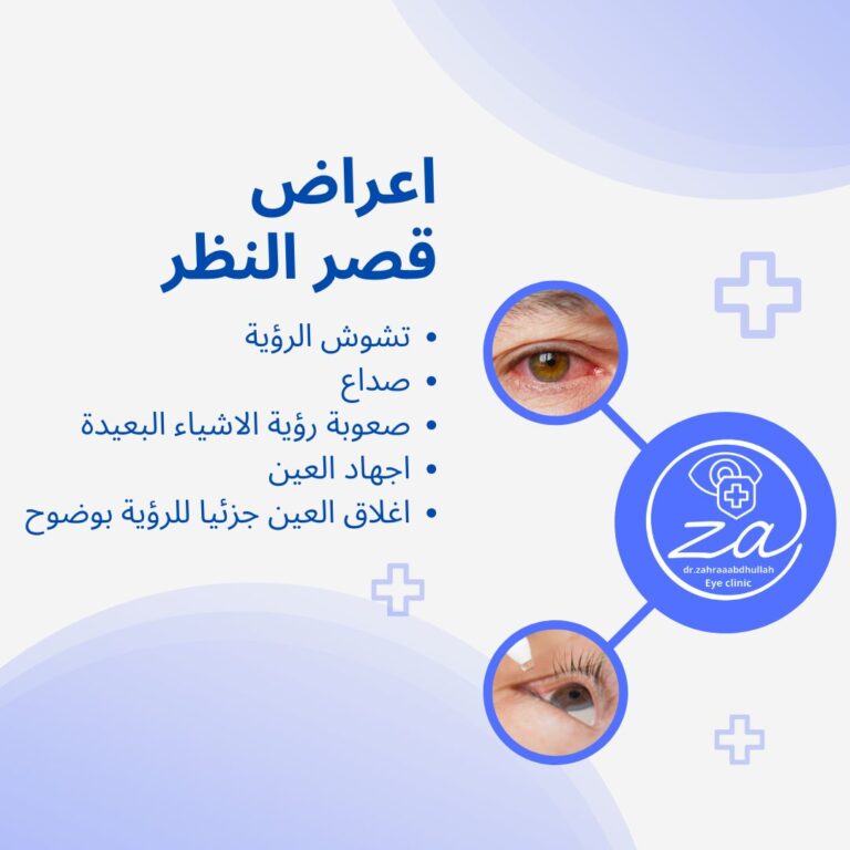 قصر النظر 768x768