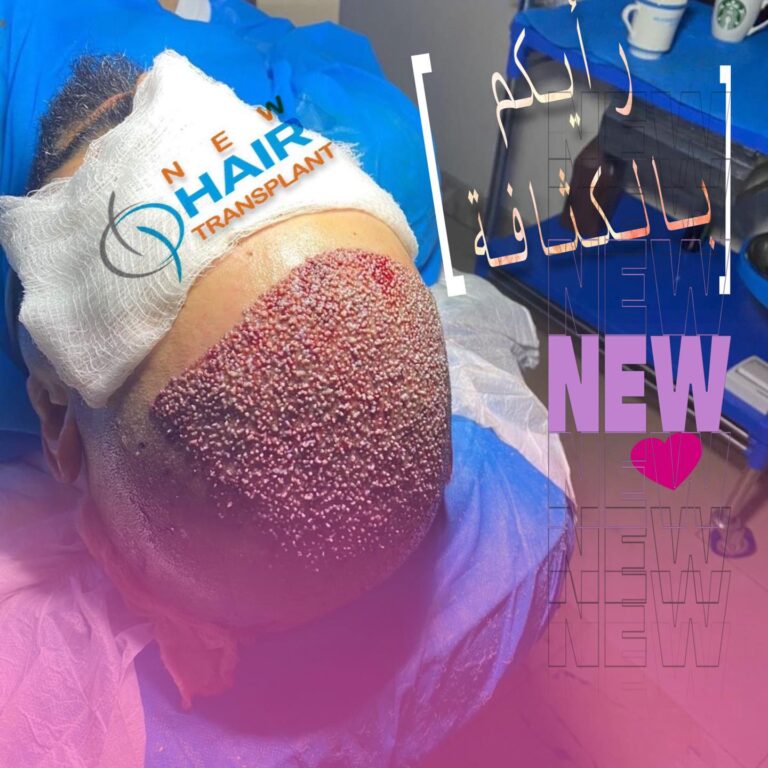 كثافه 1 768x768