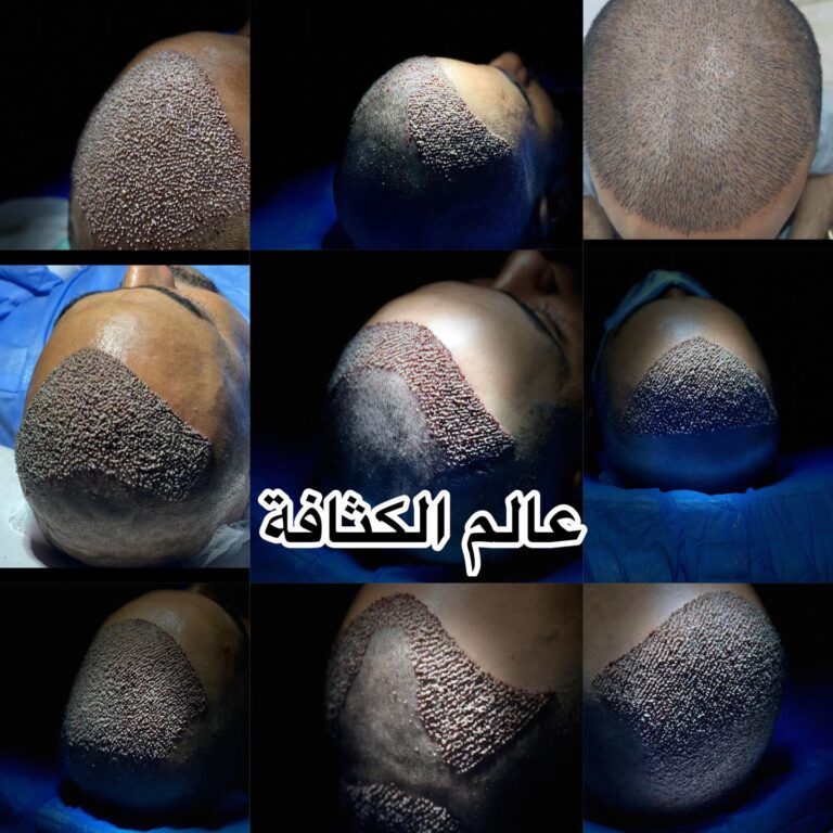 كثافه في الزراعة 768x768